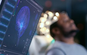 a patient's brain scan